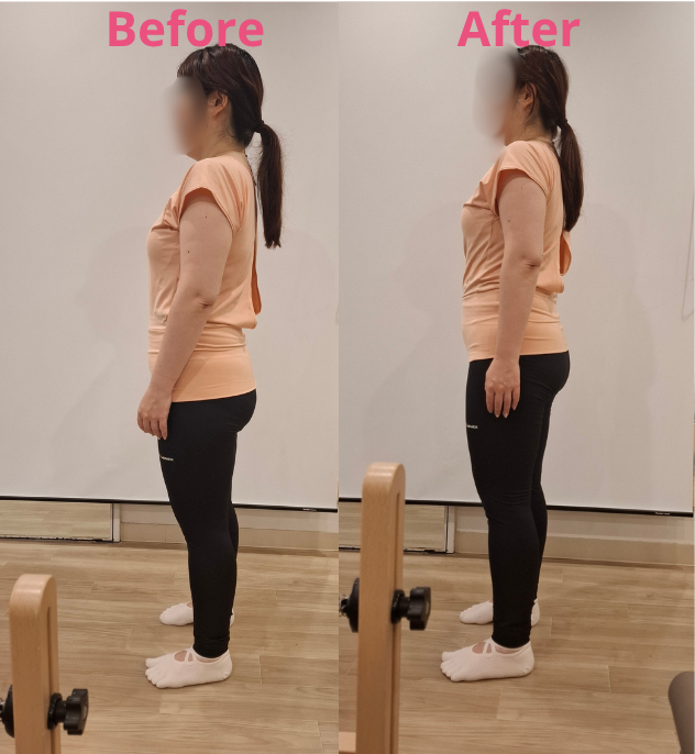 リントスルパーソナルレッスンのbefore & after